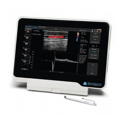 画像1: 超音波診断装置 uSmart 3200T VET