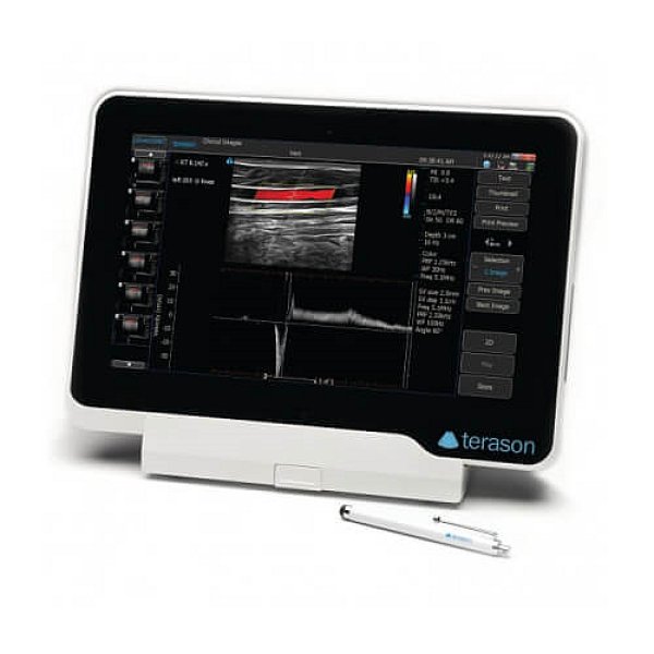 画像1: 超音波診断装置 uSmart 3200T VET (1)